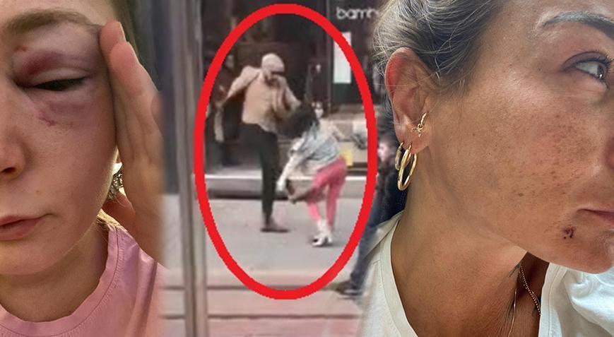 Korkunç rakam! Bursa’da ilk 6 ayda, 6 bin 537 kadın ile 755 erkek eşlerinden şiddet gördü